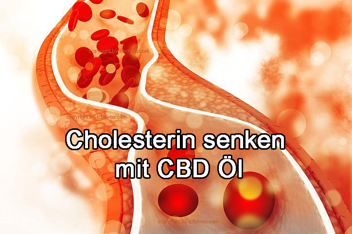 cholesterin senken mit cbd